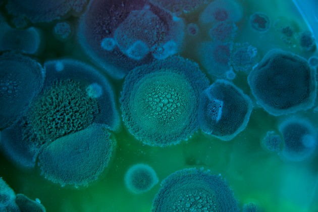 close-up photo of aspergillus mould in a petri dish